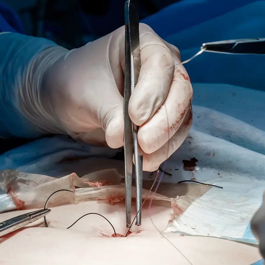 Dermatologische Operation